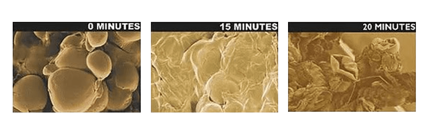 Actual Photos of Fat Melting Away After Just One Treatment