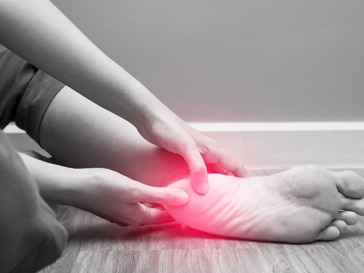 Plantar Fasciitis
